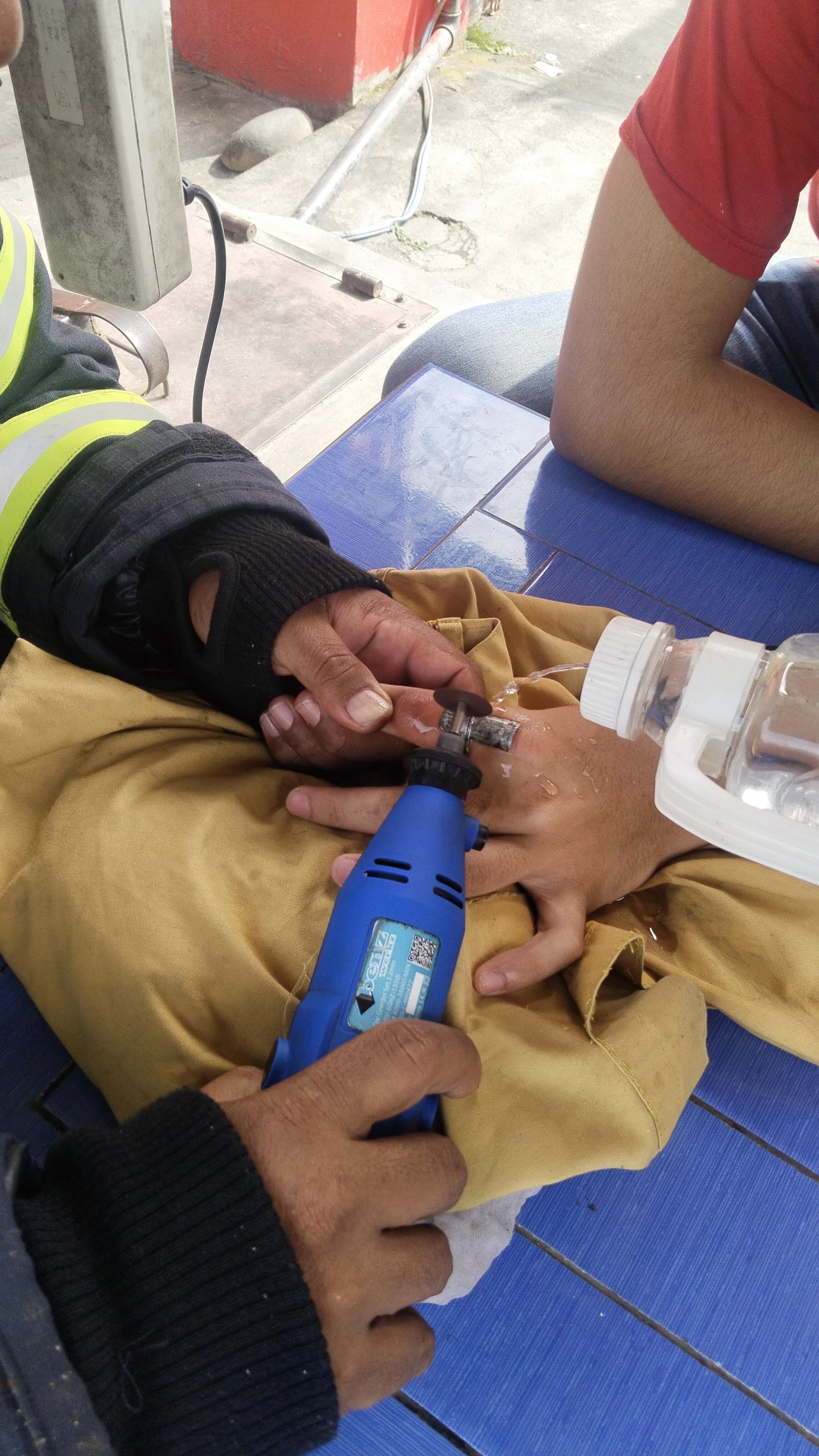 Pelepasan cincin yang tidak bisa lepas dari jari warga yang beralamat tinggal di Jl. Sekka nauli