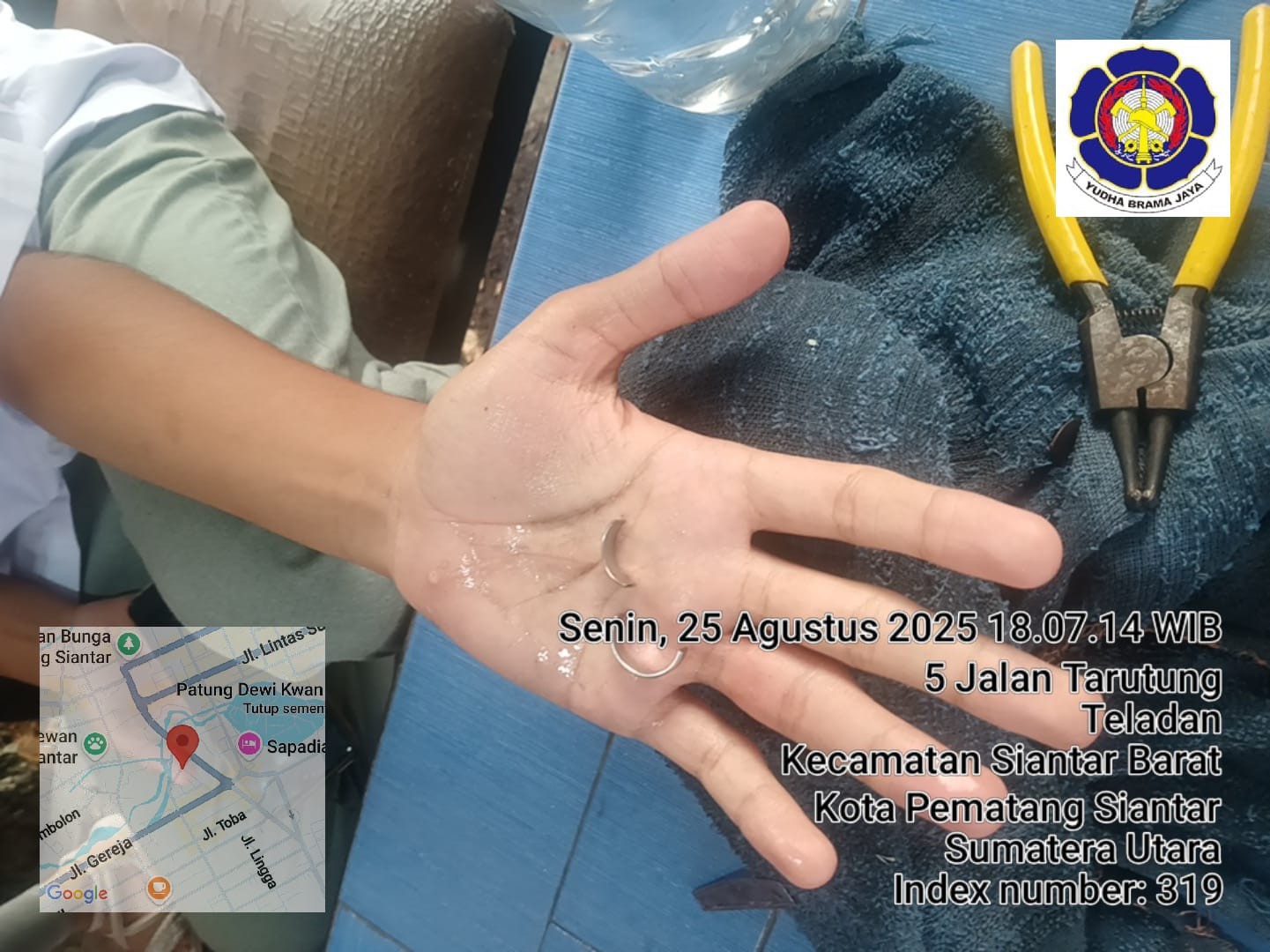 pelepasan cincin dari jari seorang warga yg tidak bisa dilepas yang beralamat di  Jl. Gereja