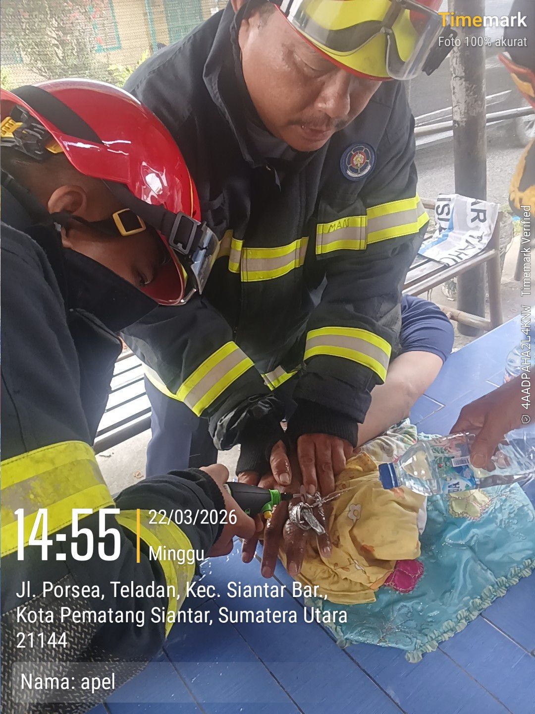 pelepasan cincin dari jari seorang warga yg tidak bisa dilepas.