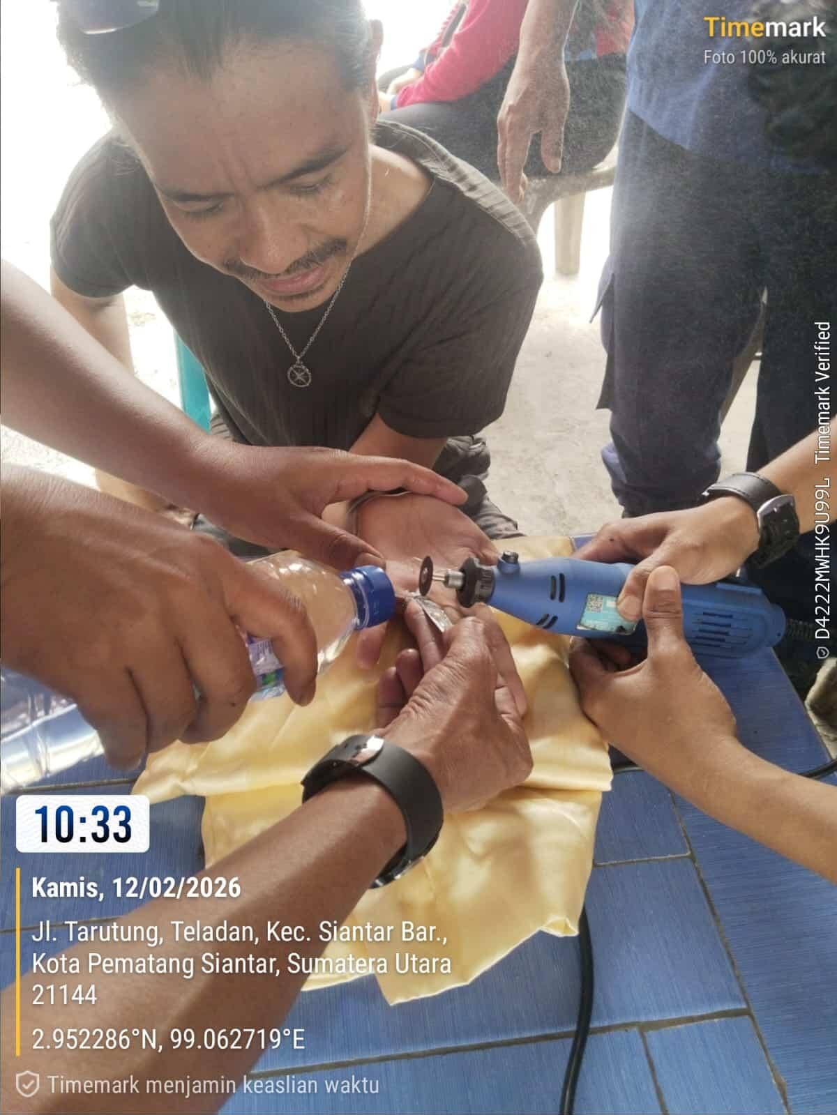 pelepasan cincin dari jari seorang warga yg tidak bisa dilepas.